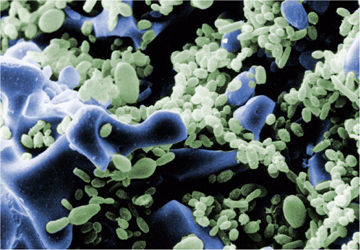 Resultado de imagen de bacterias siporax